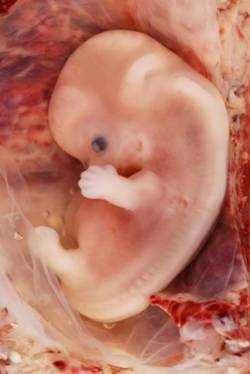 Pregnancy Fetal Develoment Week 9