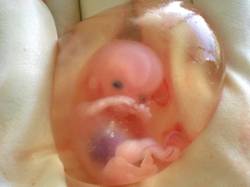 Pregnancy Week 10-11 Fetal Development
