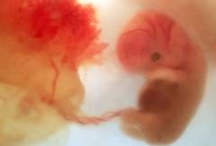 http://selmapreghelp.com/wp-content/uploads/2012/01/phototake_photo_of_8_week_fetus-300x203.jpg
