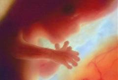 http://selmapreghelp.com/wp-content/uploads/2012/01/phototake_photo_of_12_week_fetus-300x203.jpg