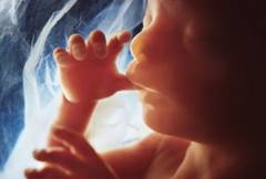 http://selmapreghelp.com/wp-content/uploads/2012/01/nilsson_rm_photo_of_20_week_fetus-300x203.jpg