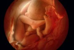 http://selmapreghelp.com/wp-content/uploads/2012/01/nilsson_rm_photo_36_week_fetus-300x203.jpg